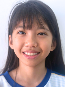 Chỉnh nha bác sĩ miên, chỉnh nha đắk lắk, niềng răng bác sĩ miên, nha khoa bác sĩ miên, niềng răng đắk lắk